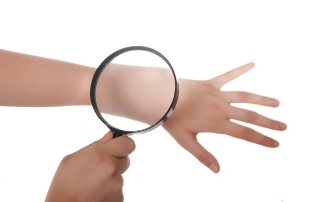 Препараты для лечения псориаза