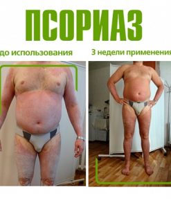 Крем Акрустал Пихтовая Формула 65 мл. 2 Крем Акрустал Пихтовая Формула 65 мл. отзывы