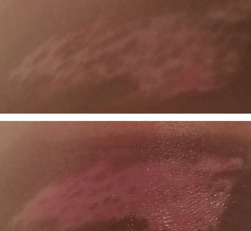 Дермалайт 311 - инновации на службе вашей красоты Дермалайт 311 - инновации на службе вашей красоты