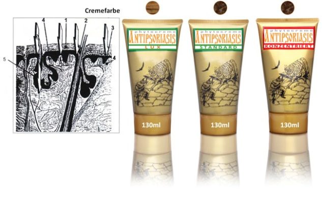 Обзор кремов "Антипсориаз"