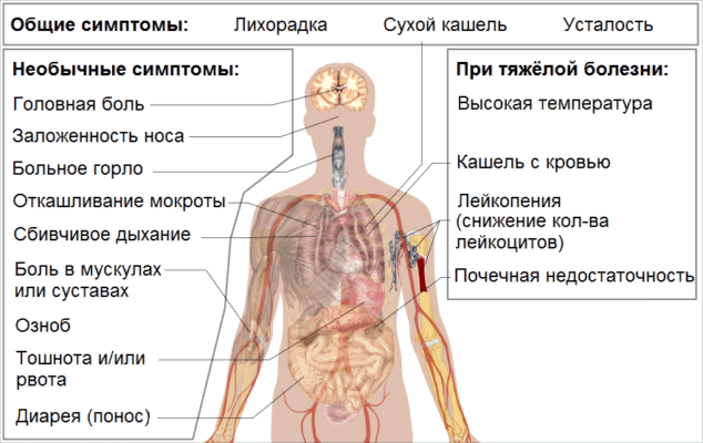 Коронавирус COVID-19 и витилиго 3 Symptoms of coronavirus disease 2019 2.0 ru