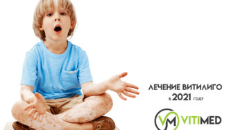 Лечение витилиго в 2021 году