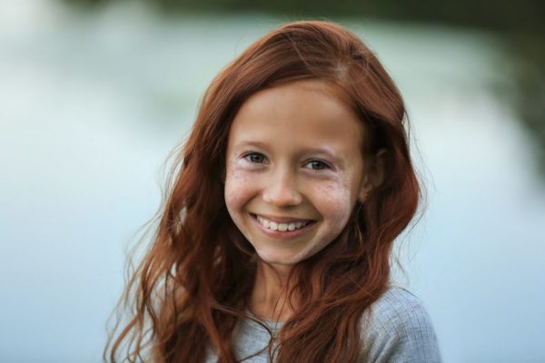 Витилиго у детей лечение