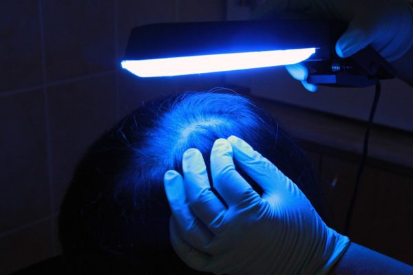 Лечение грибка ультрафиолетом