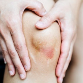 Когда человек заболевает псориазом? Когда человек заболевает псориазом?