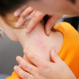 Псориаз: диагностика и лечение Псориаз диагностика и лечение