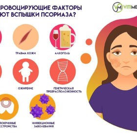 КАКИЕ ПРОВОЦИРУЮЩИЕ ФАКТОРЫ ВЫЗЫВАЮТ ВСПЫШКИ ПСОРИАЗА