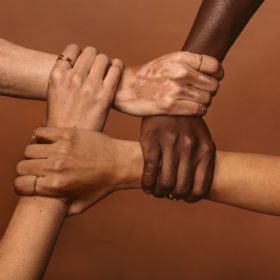Кто болеет витилиго и что его провоцирует Кто болеет витилиго и что его провоцирует