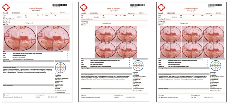Видеокольпоскоп Kernel KN-2200A (Q) 14 istorija 768x348 5