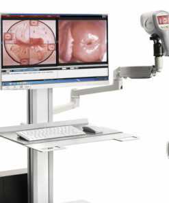 Видеокольпоскоп Kernel KN-2200C (F) 4 kn 2200c hd 01 1000x1000 1