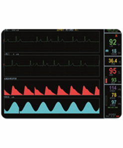 Монитор пациента Kernel KN-601M 2 monitor pacienta kn 601m 03 1000x1000 1
