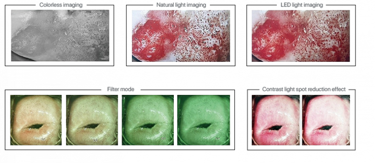 Видеокольпоскоп Kernel KN-2200A (Q) 12 snimki 768x335 5